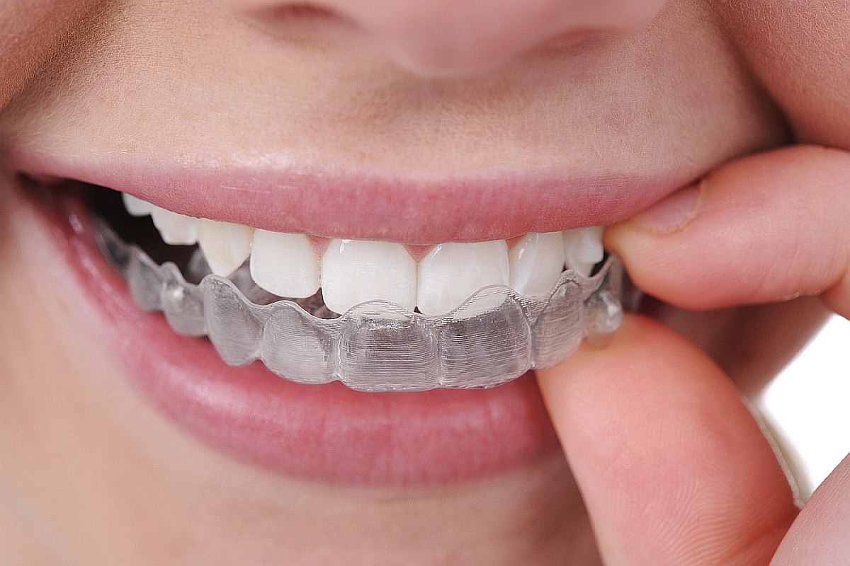 orthodontist invisible braces essen duesseldorf